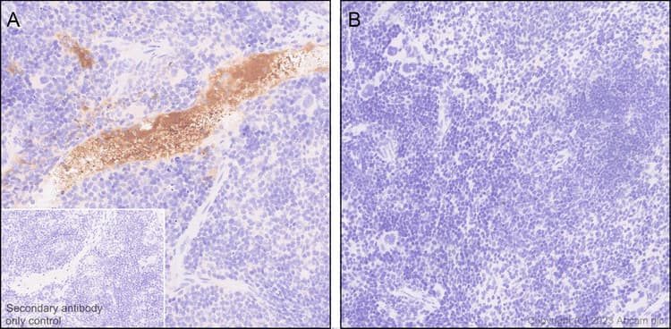 Complement Factor B Antibody Epr27443 6 Bsa And Azide Free Ab309150  Immunohistochemistry Formalin Pfa Fixed Paraffin Embedded Sections Img409468