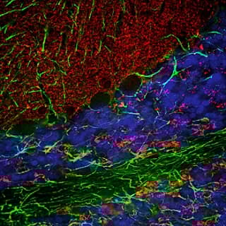 Anti-Alpha-synuclein antibody(AB190376)