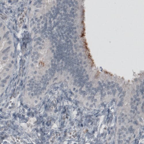 Anti-MUC16 antibody [CL2782](ab272333)