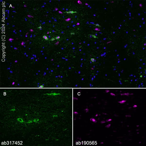 Anti-VAChT antibody [EPR29154-71](AB317452)