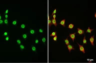 Anti-Dnmt3a antibody - N-terminal(AB228691)