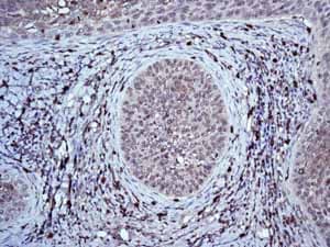 Anti-HIF-1 alpha antibody [EP1215Y](ab51608)
