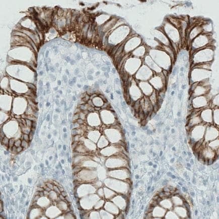 Carbonic Anhydrase 12 Ca12 Antibody Cl0278 Ab242316  Immunohistochemistry Formalin Pfa Fixed Paraffin Embedded Sections Img18947