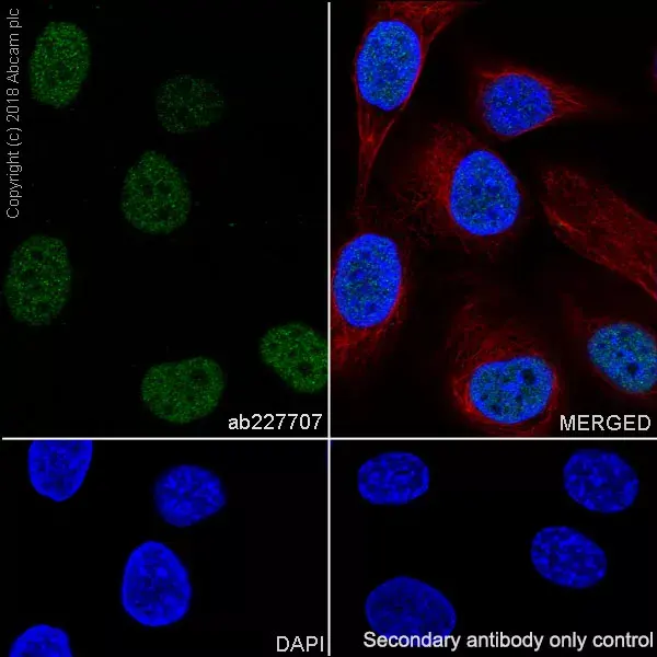 Anti-PAX8 antibody [SP348] - N-terminal(AB227707)