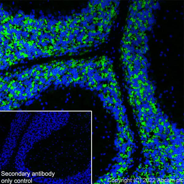 Anti-GABRD antibody [EPR25324-253](AB300348)