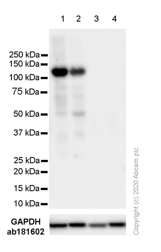 Anti-Androgen Receptor antibody [ER179(2)] - ChIP Grade(AB108341)