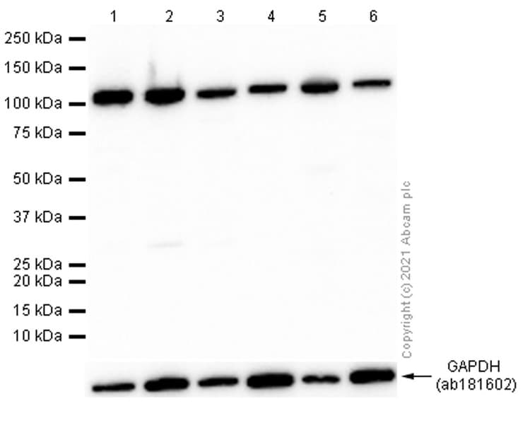 Anti-OGT / O-Linked N-Acetylglucosamine Transferase antibody [EPR12713] - BSA and Azide free(AB236014)