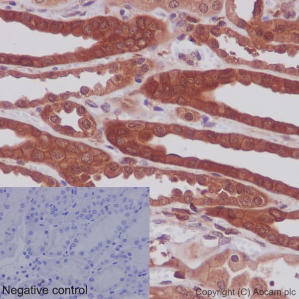 Anti-MEK1 + MEK2 antibody [EPR16667](AB178876)
