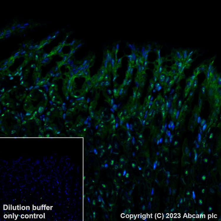 Alexa Fluor 488 Brd4 Antibody Epr51502 Ab197606  Immunohistochemistry Formalin Pfa Fixed Paraffin Embedded Sections Img448809