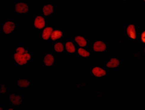 Anti-SOX9 antibody [EPR12755](AB182579)
