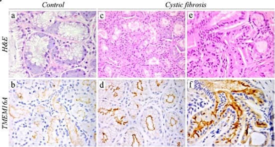 Anti-TMEM16A antibody [SP31](ab64085)