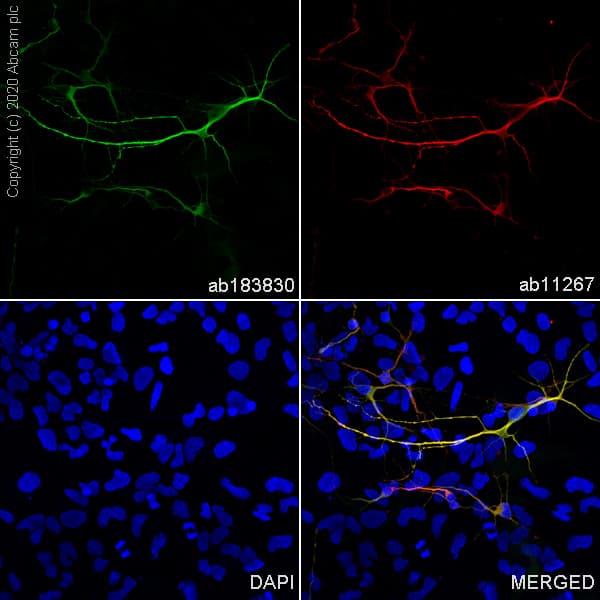Anti-MAP2 antibody [EPR19691](AB183830)