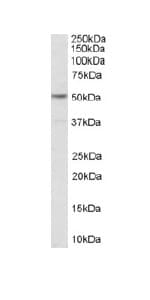 5 Ht2c Receptor Antibody Ab32887  Western Blot Img3676