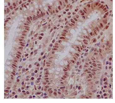 Anti-EXOSC3 antibody [EPR14840(B)] - N-terminal(AB184961)