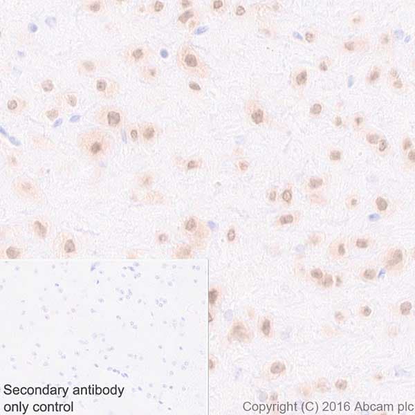 Anti-HuD + HuC antibody [EPR19098](AB184267)