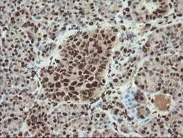 Samhd1 Antibody Oti1a1 Ab128107  Immunohistochemistry Formalin Pfa Fixed Paraffin Embedded Sections Img130384