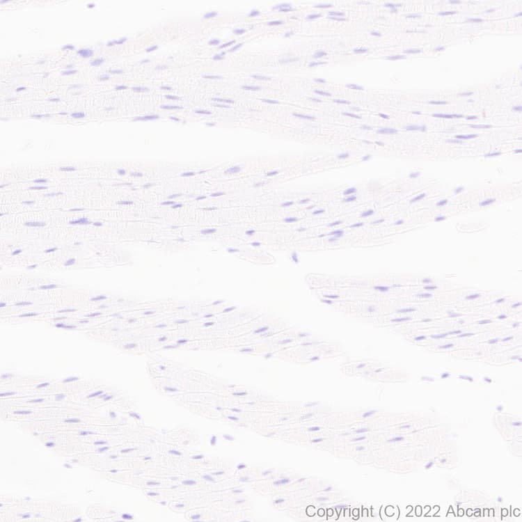 Anti-MAdCAM1 antibody [EPR27223-77](AB307827)