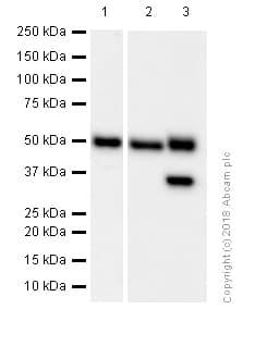 Anti-MMP3 antibody [EP1186Y](AB52915)