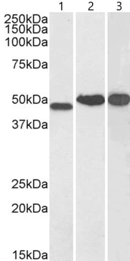 Ndrg1 Antibody Ab37897  Western Blot Img97499