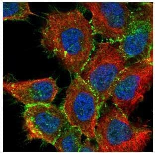 Anti-beta Catenin antibody - ChIP Grade(AB227499)