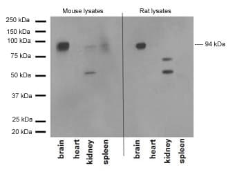 Braf Antibody Ep152y Ab33899  Western Blot Img18548