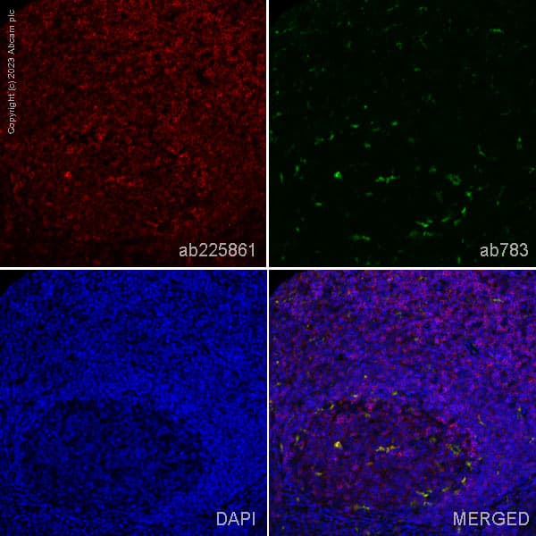 Anti-TREM1 antibody [EPR22060-229](AB225861)