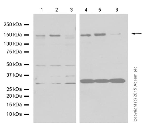 Anti-LDL Receptor antibody [EP1553Y](AB52818)