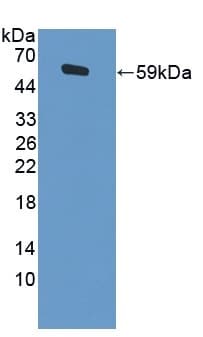 Anti-ADNP antibody(AB231950)