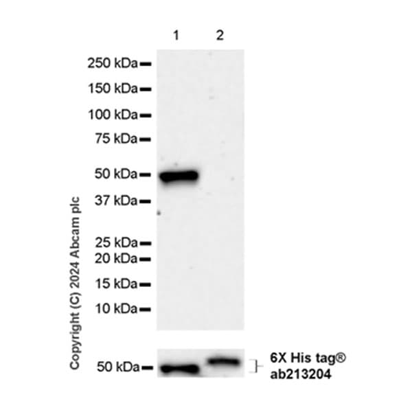 Fgfr2iiib Fgfr2b Antibody Epr28355 27 Ab318274  Western Blot Img433052