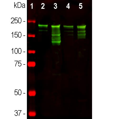 Anti-Neurofilament heavy polypeptide antibody(AB8135)