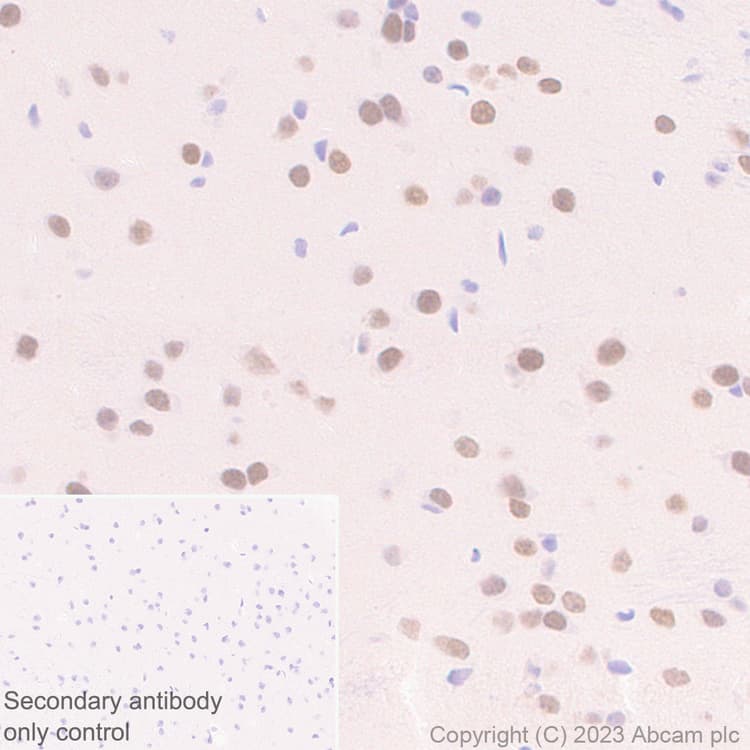 Anti-Homeobox protein cut-like 2 antibody [EPR26509-79](AB315796)