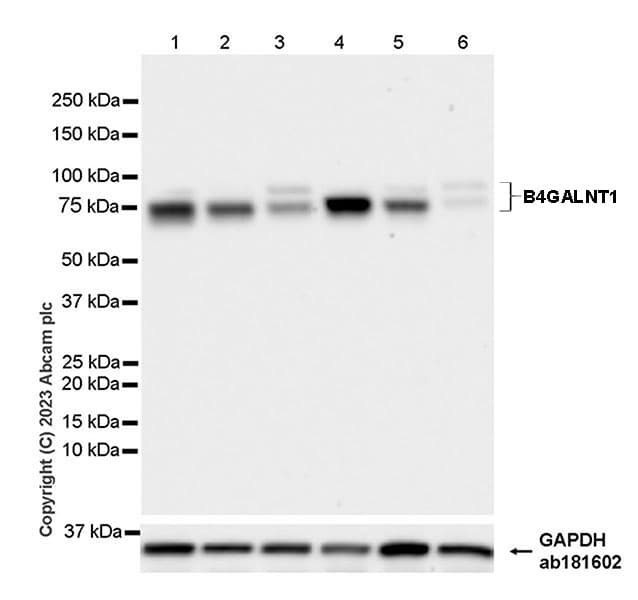 B4galnt1 Antibody Epr28064 64 Ab314130  Western Blot Img419961