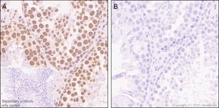 Anti-RNA polymerase II CTD repeat YSPTSPS (phospho S5) antibody [EP1510Y](AB76292)