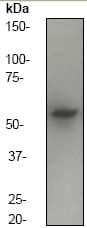 Alpha Internexin Antibody Ep676y Ab40758  Western Blot Img81230