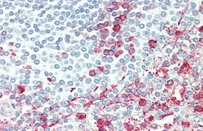 Anti-ITGB6 antibody(AB233519)