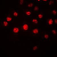 Anti-HOXA1 antibody(AB230513)