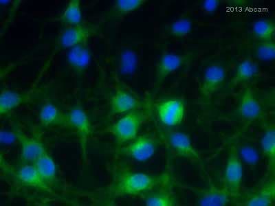 Trp2 Dct Antibody Ab74073  Immunocytochemistry Immunofluorescence Img68813