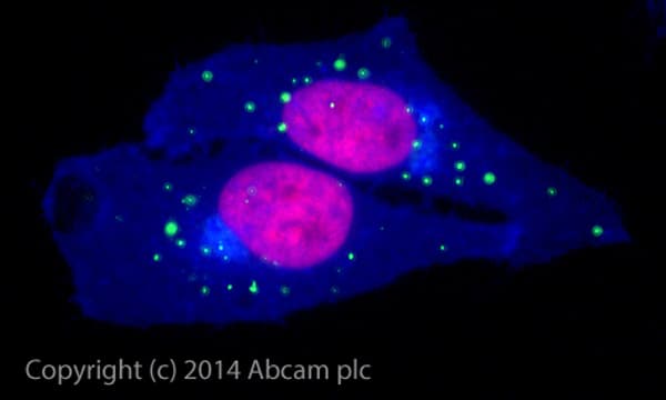 Alexa Fluor® 488 Anti-SQSTM1 / p62 antibody [EPR4844] - Autophagosome Marker(AB185015)