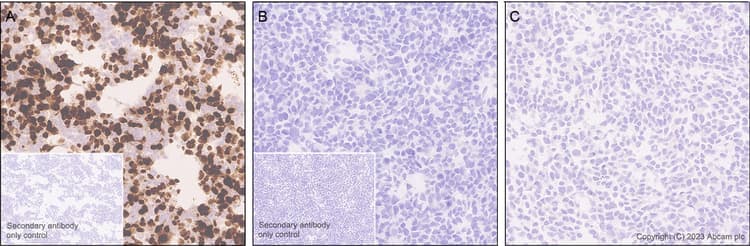 Anti-Homeobox protein cut-like 2 antibody [EPR26509-79](AB315796)