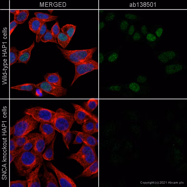 Alpha Synuclein Antibody Mjfr1 Bsa And Azide Free Ab209420 Immunocytochemistry Immunofluorescence Img125804
