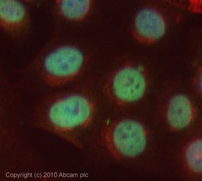 Anti-PHD finger protein 1/PHF1 antibody(AB80042)