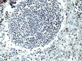 Pstpip1 Antibody Ab197260  Immunohistochemistry Formalin Pfa Fixed Paraffin Embedded Sections Img126425