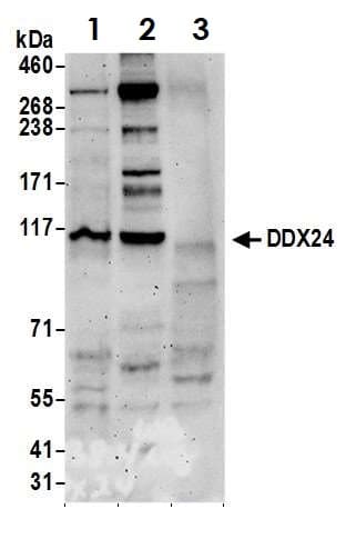 Anti-DDX24 antibody(ab70463)