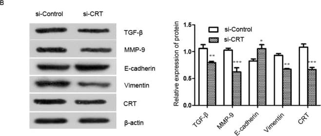 Anti-Calreticulin antibody [EPR3924] - ER Marker(AB92516)