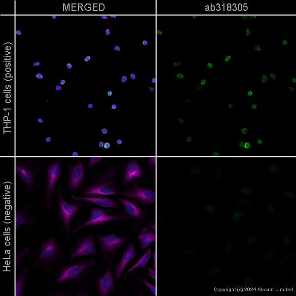 Anti-Iba1 antibody [EPR16588] – Chicken IgY (Chimeric)(AB318302)
