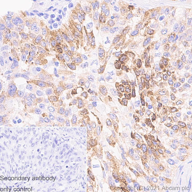 Anti-iNOS antibody [RM1017](AB283655)