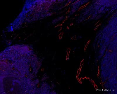 Anti-NOTCH3 antibody(AB23426)