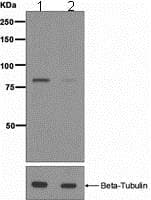 Hormone Sensitive Lipase Hsl Phospho S853 Antibody Epr23292 Bsa And Azide Free Ab247849  Western Blot Img114033