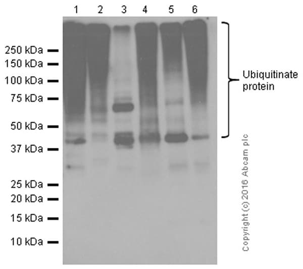 Anti-Ubiquitin (linkage-specific K48) antibody [EP8589](AB140601)