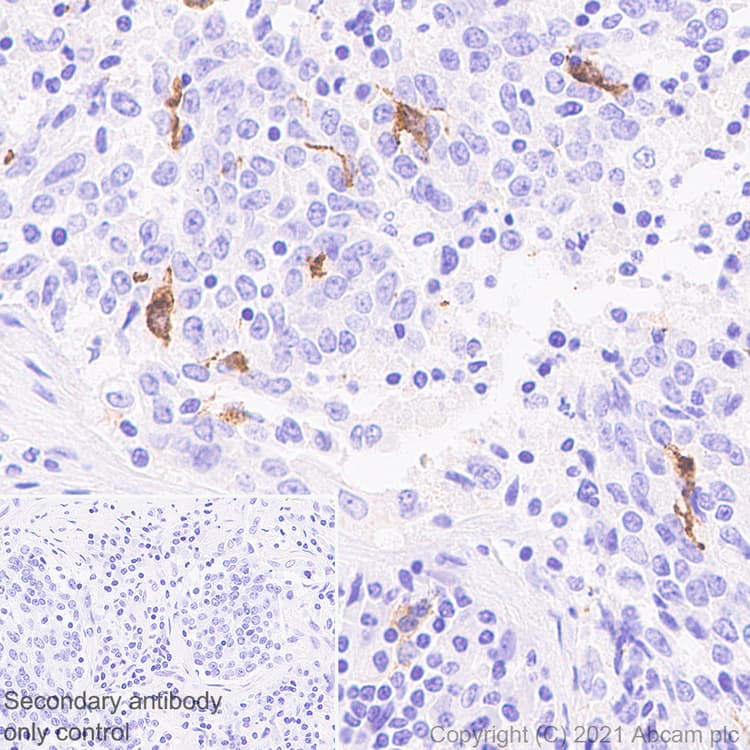 Anti-Langerin antibody [EPR24685-12](AB283686)